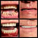 Slider image (9) Kool Dental